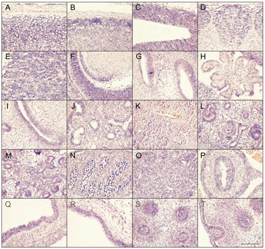 Expression of <i>SLC29A3</i> mRNA in the mouse embryo.