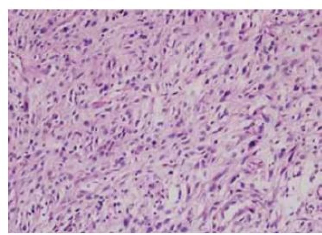 Histologický nález – barvení hematoxilin-eozin, zvětšení 20krát.