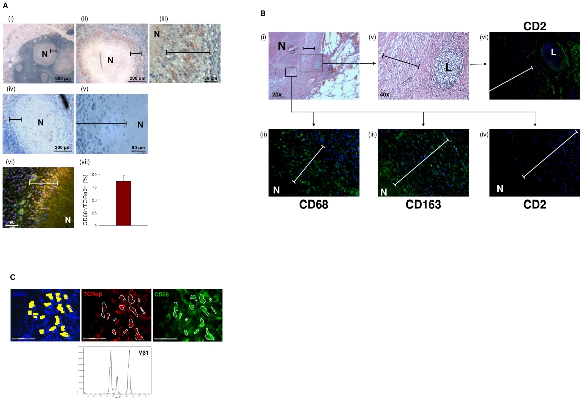 Massive accumulation of TCRαβ<sup>+</sup> macrophages in the inner epithelioid cell corona of human tuberculous granulomas.