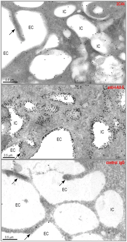 Visualization of I-A<sup>d</sup>/LACK complexes by immunogold electron microscopy.
