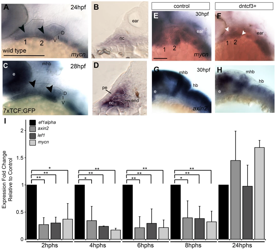 Wnt signaling in the pharyngeal arches.