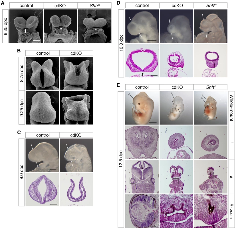Analysis of the HPE phenotype in cdKO embryos.