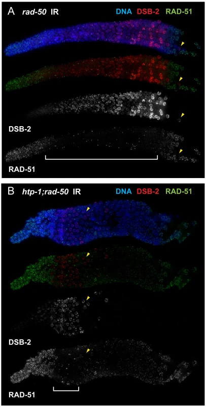 DSB-2 marked nuclei require RAD-50 for formation of RAD-51 foci after irradiation.