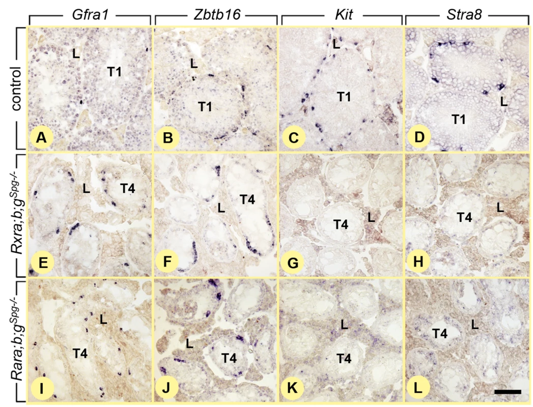 Ablation of RXR blocks spermatogonia are at the undifferentiated stage.