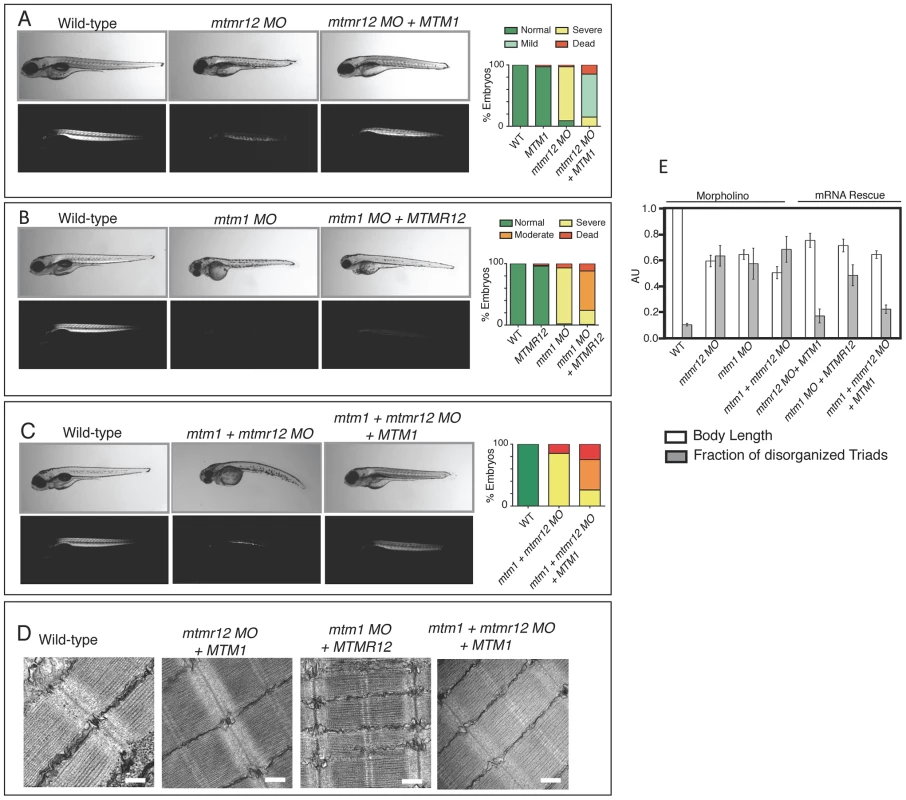 Rescue of <i>mtmr12</i> morphant phenotypes by <i>MTM1</i>.