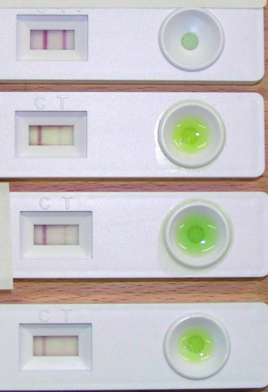 Srovnání výsledků několika postupně hodnocených testů Saliva-check mutant 
u jednoho pacienta