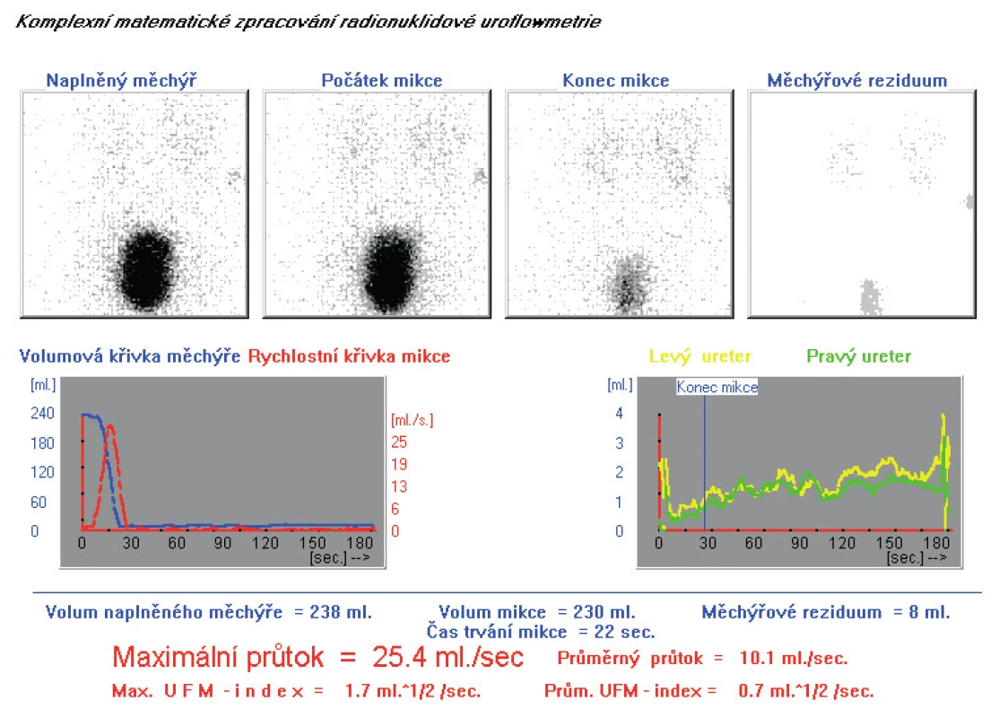 Normální nález při NR UFM s normálními hodnotami funkčních parametrů
