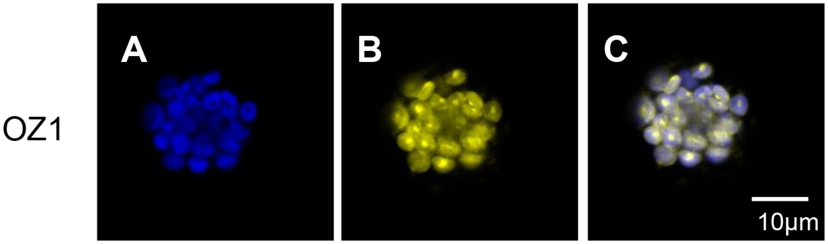Localization of YFP fusion to OZ1 N-terminal sequence at punctuate loci in chloroplasts.