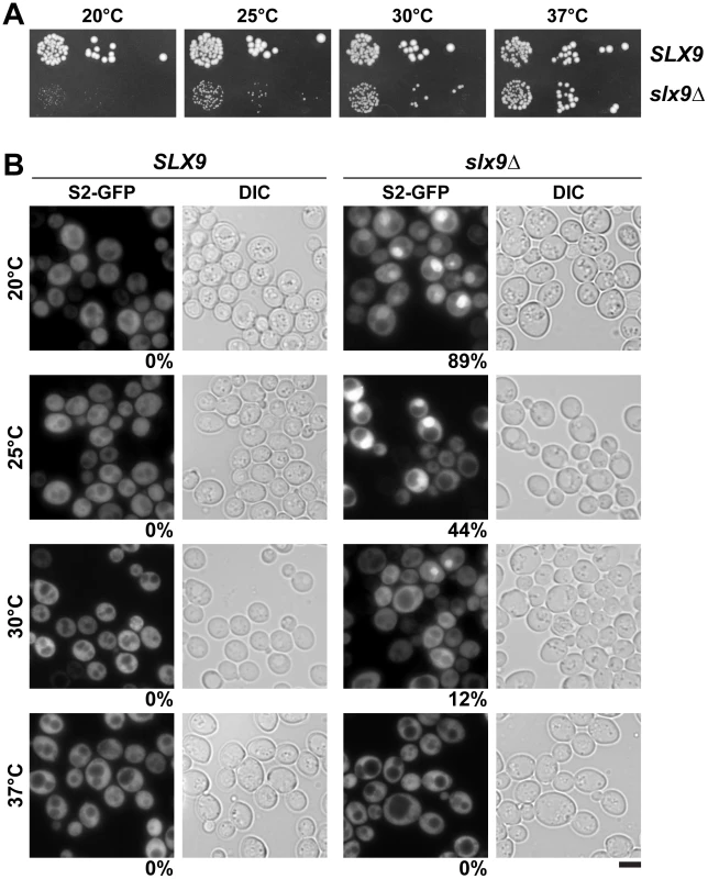 Slx9 is required for proper nuclear export of 40S pre-ribosomes.