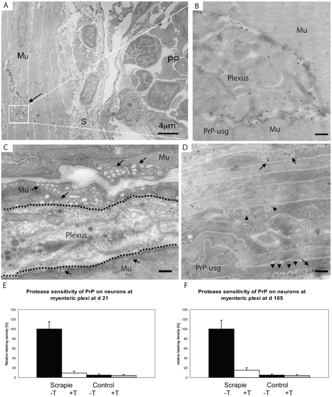 First PrP observed in myenteric plexi.