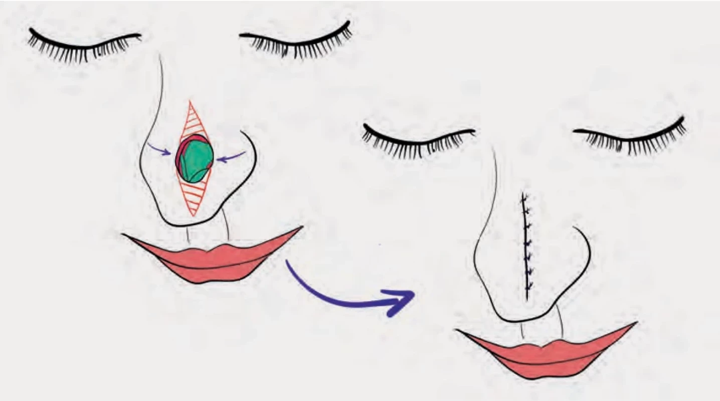 Fig. 2.