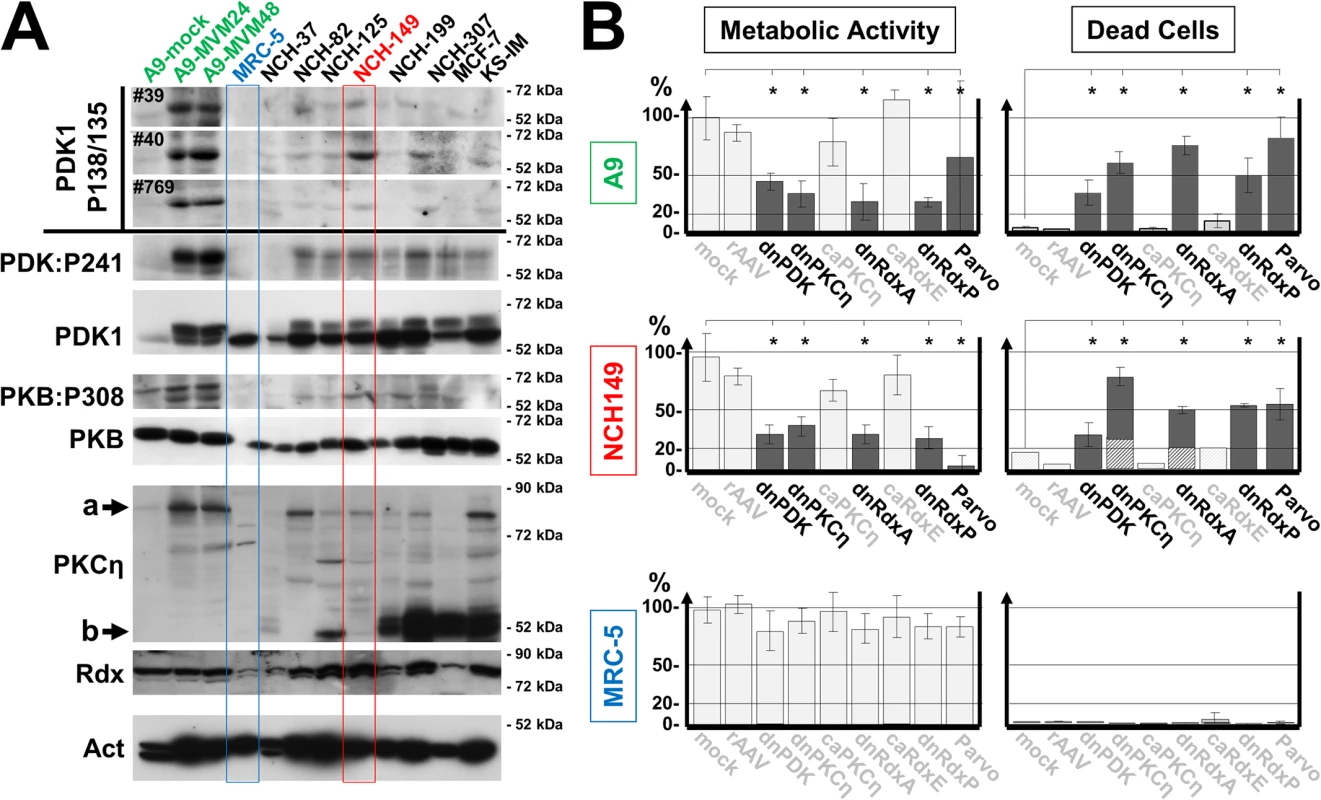 Detection of PDK1phosphoS135 in human cancer-derived cell lines.