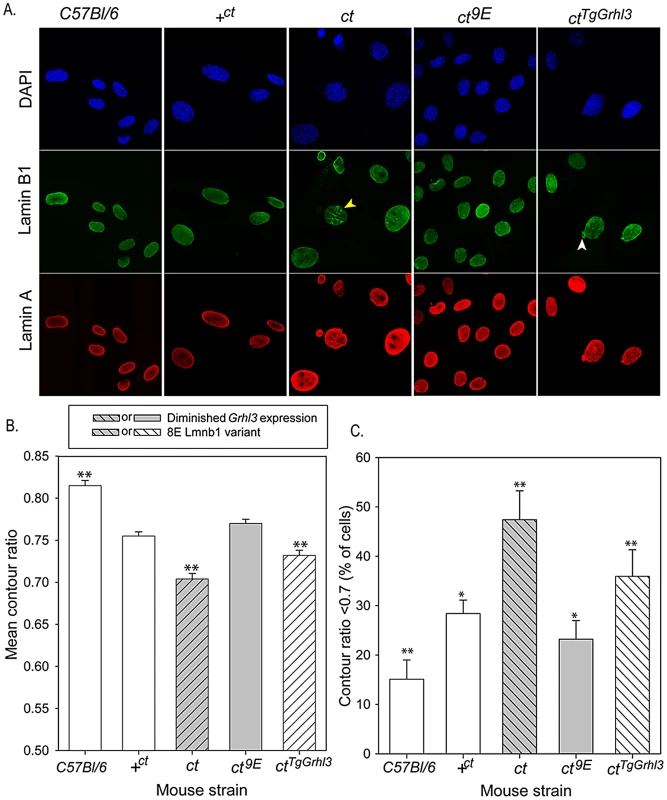 Nuclear morphology is influenced by Lamin B1 variation.