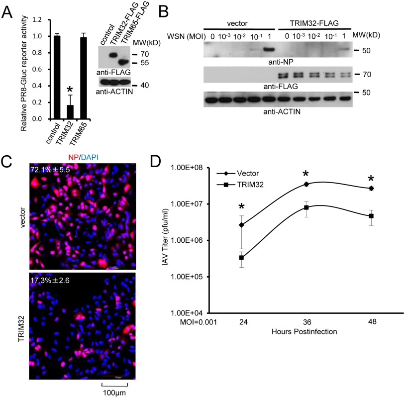 TRIM32 attenuates influenza A virus infection.