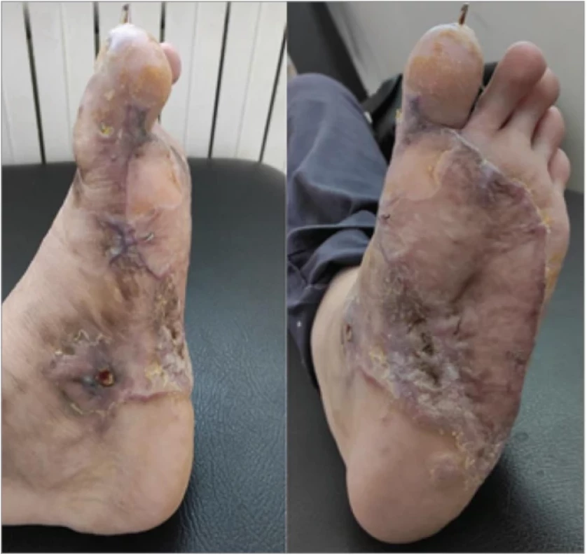 Late postoperative result (2 months after surgery).