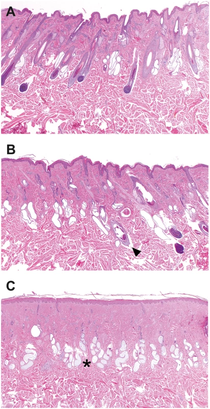Histopathology of skin samples from a cow with streaked hairlessness.