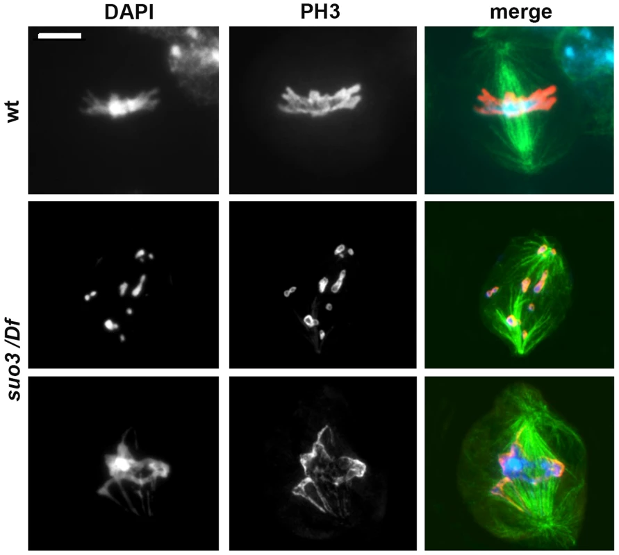 Examples of the rare mitotic metaphases observed in <i>Top<sup>suo3</sup>/Df</i> mutants.