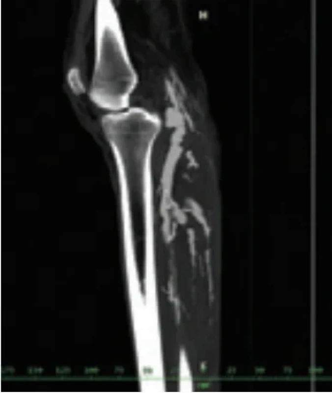  / Fig. 2.