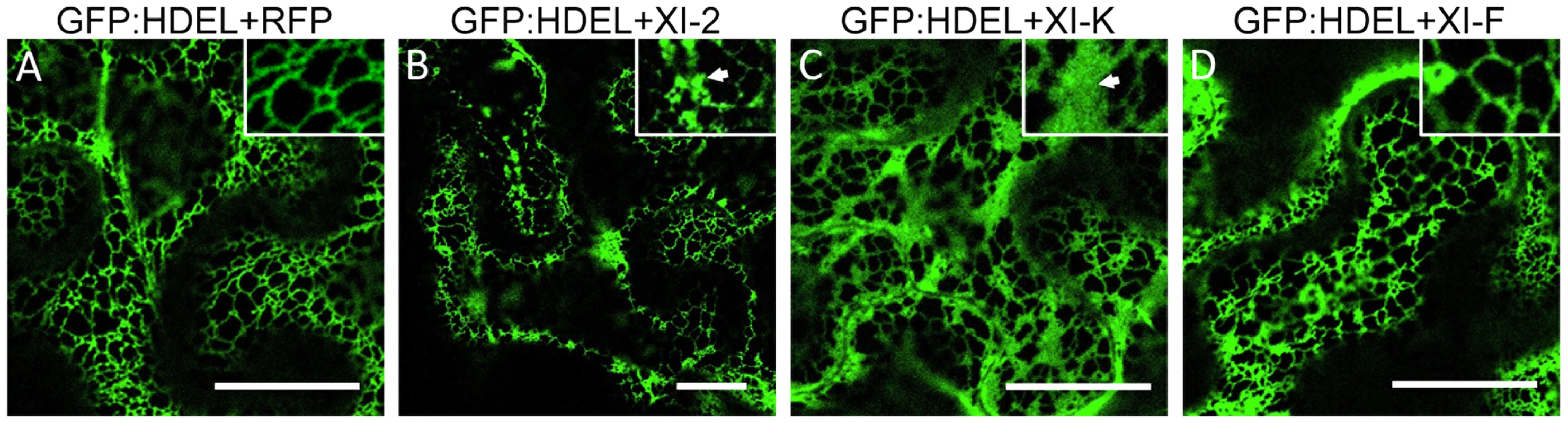 Effect of specific myosin tail expression on ER structure.
