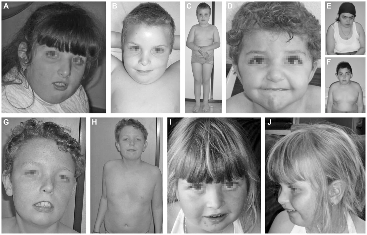 Clinical features of the seven cases.