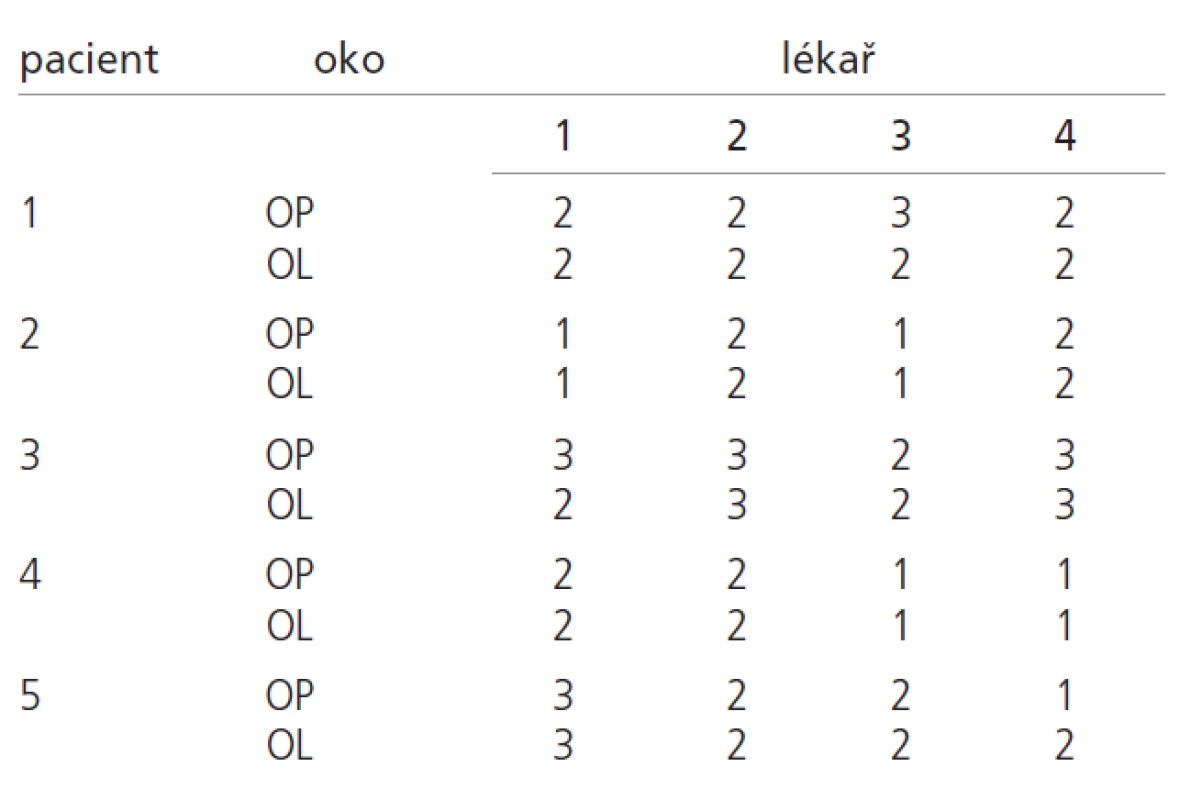 Určování prominence papiledému v dioptriích.