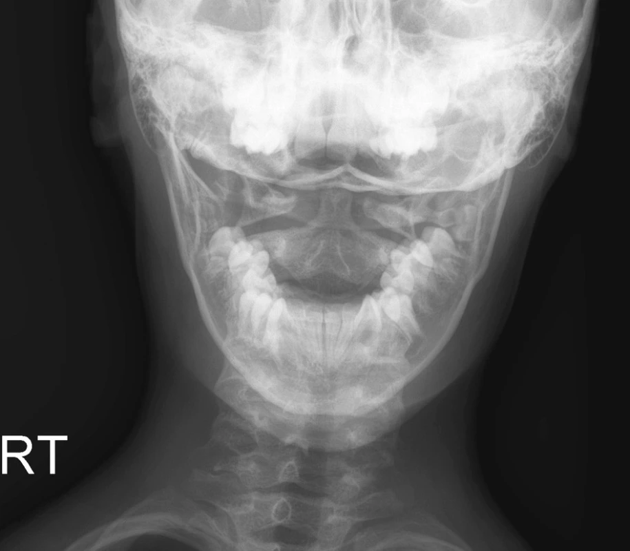 <br>Fig. 4.