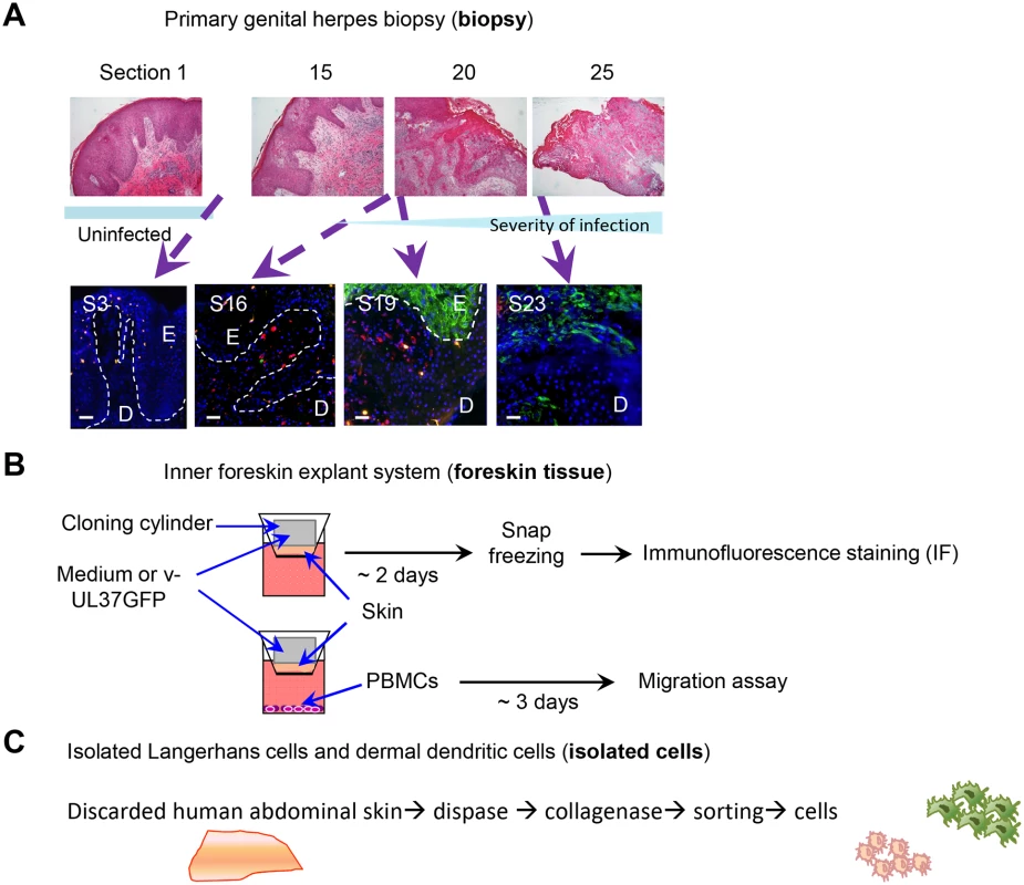 Schemes of experimental systems used to examine LCs and dermal DC interaction