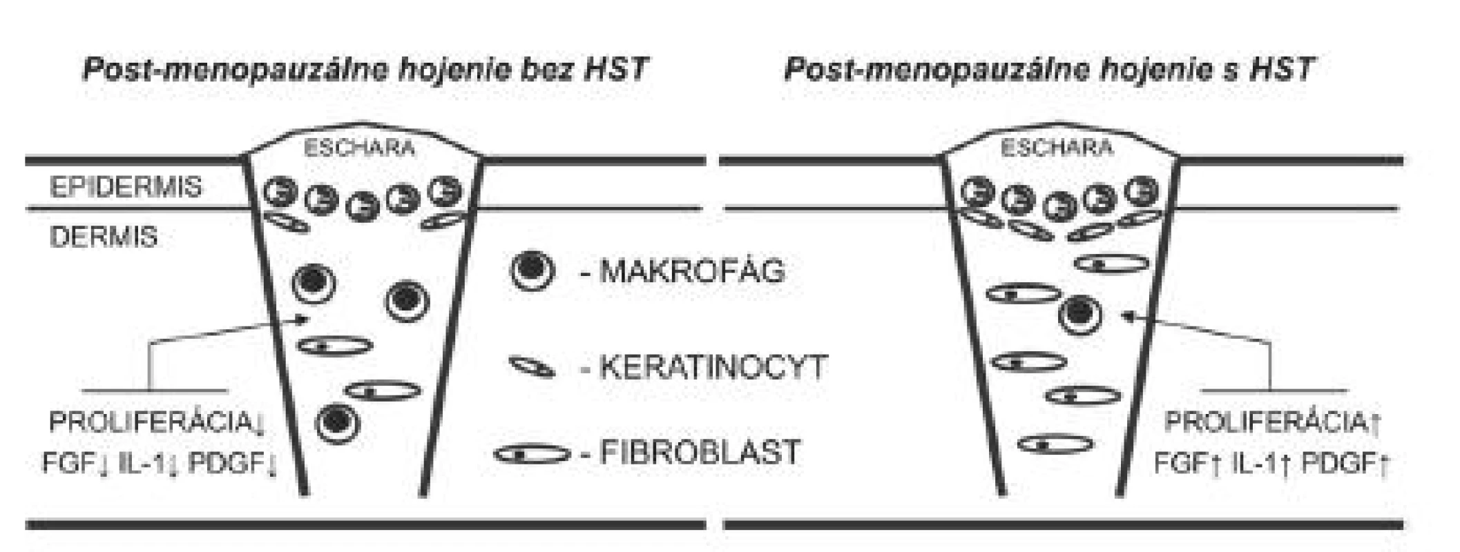 Proliferačná fáza hojenia rán prebieha v post-menopauzálnom období života výrazne spomalene. Charakteristická je znížená expresia viacerých rastových faktorov vrátane FGF, IL-1 a PDGF, čo vedie k inhibícii tvorby granulačného tkaniva. HST je schopná stimulovať hojenie až na úroveň normálneho pre-menopauzálneho stavu. HST – hormonálna substitučná terapia, FGF – fibroblastový rastový faktor, IL-1 – interleukín 1, PDGF – rastový faktor odvodený od krvných doštičiek