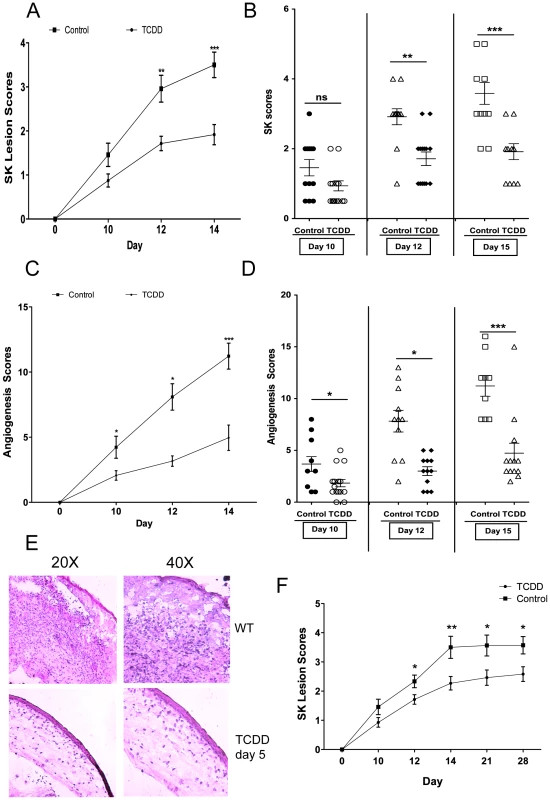 Therapeutic administration of TCDD diminishes SK severity.