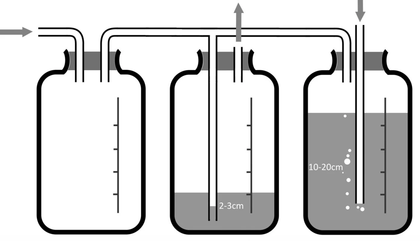 Systém pro balancovanou drenáž
Fig. 8: Balanced drainage system