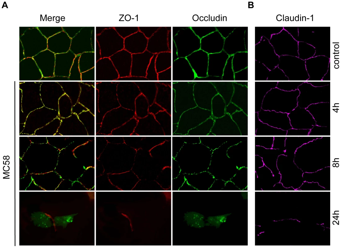Effect of <i>N. meningitidis</i> on the tight junction proteins occludin, ZO-1 and claudin-1.