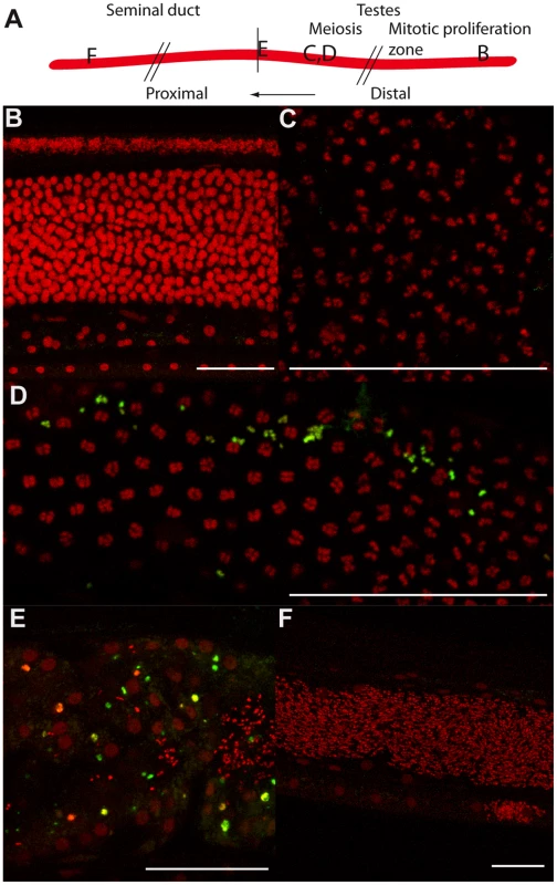 Tetracycline treatment induces detectable apoptosis during spermatogenesis.