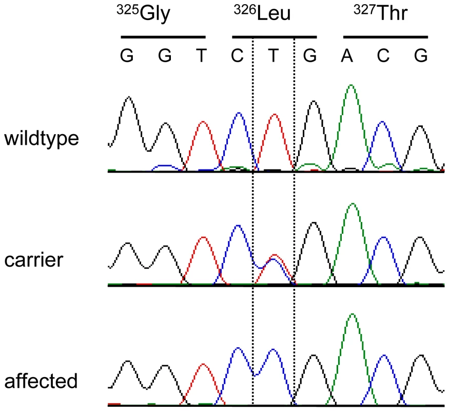 Electropherograms of the <i>SERPINH1</i> c.977T>C mutation.