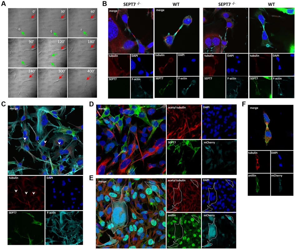 Defective cytokinesis and unresolved midbody in SEPT7-deficient fibroblasts.
