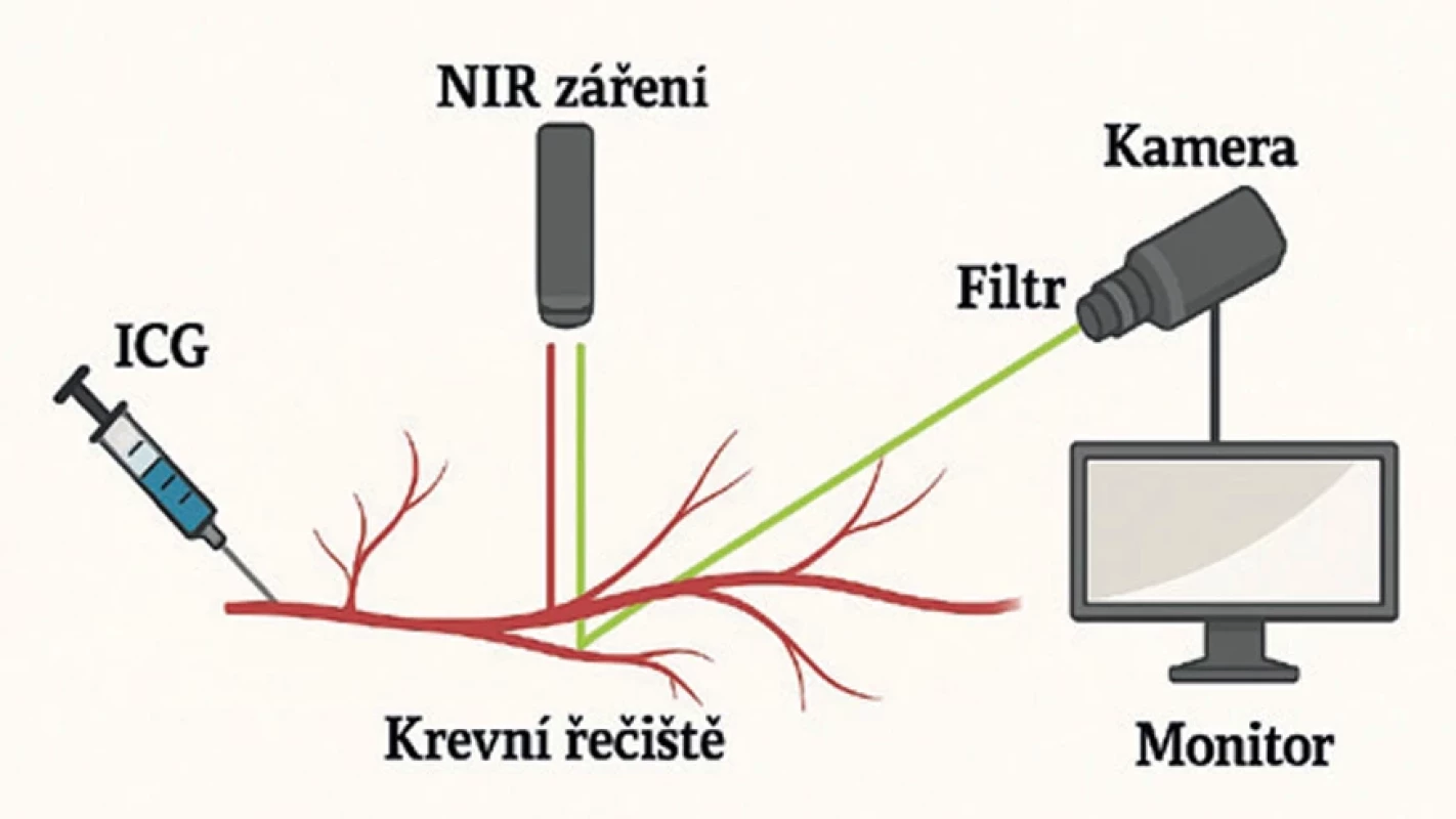 Fyzický princip fluorescenční angiografie s využitím indocyaninové zeleně v NIR spektru 