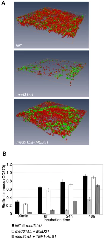 Med31 is necessary for wild-type biofilm formation, and <i>ALS1</i> is a relevant Med31 gene target for this phenotype.
