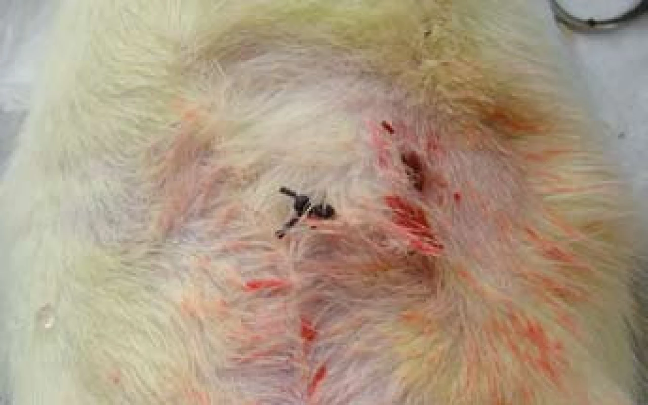 Píštěl ošetřená podvazem traktu. Stav po operaci.
Fig. 3. Fistula treated with fistula tract ligation – postoperative finding.
