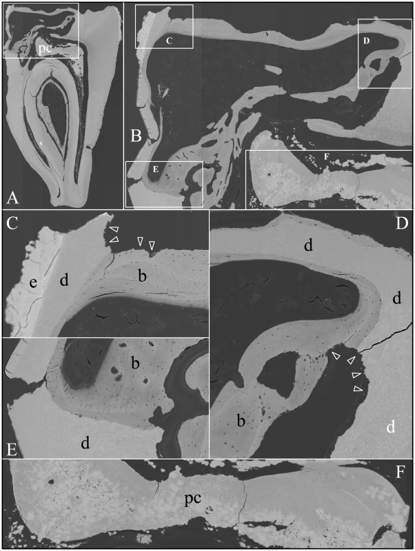 Backscatter Scanning Electron Micrographs (bSEMs) of molar (#18) crown.