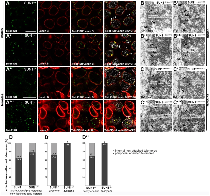 Presence of meiotic telomere attachment in <i>Sun1<sup>−/−</sup></i> mouse strains.