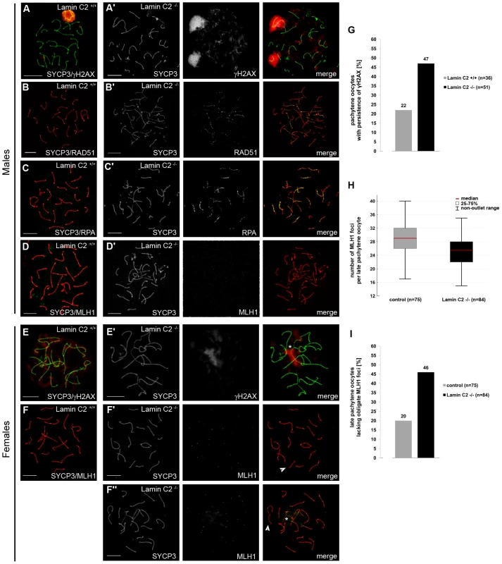 Alterations of meiotic DNA double-strand break (DSB) repair and inefficient homologous recombination caused by lamin C2 deficiency.