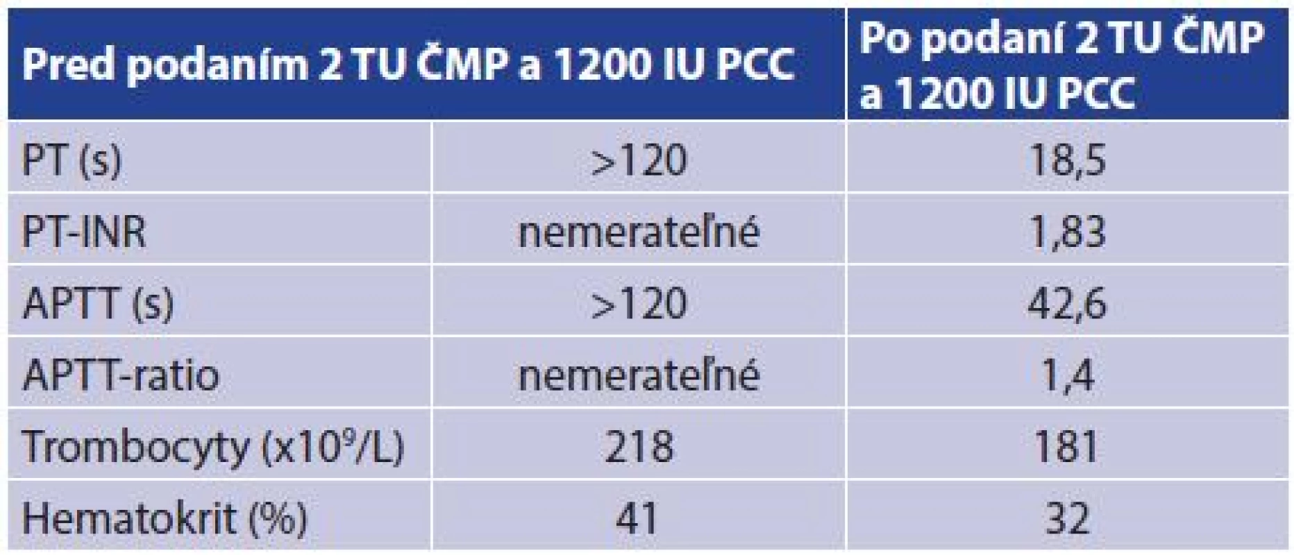Laboratórne hodnoty koagulačných testov a krvného obrazu pred a po podaní ČMP a PCC
Tab. 1: Laboratory values of coagulation tests and blood count before and after administration of fresh frozen plasma and PCC