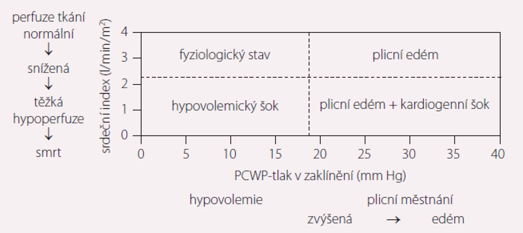 Foresterova klasifikace je založena na klinických projevech a hemodynamických parametrech.