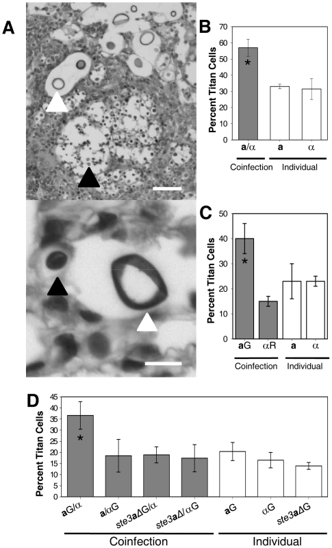 Titan cells in the lungs of coinfected mice.