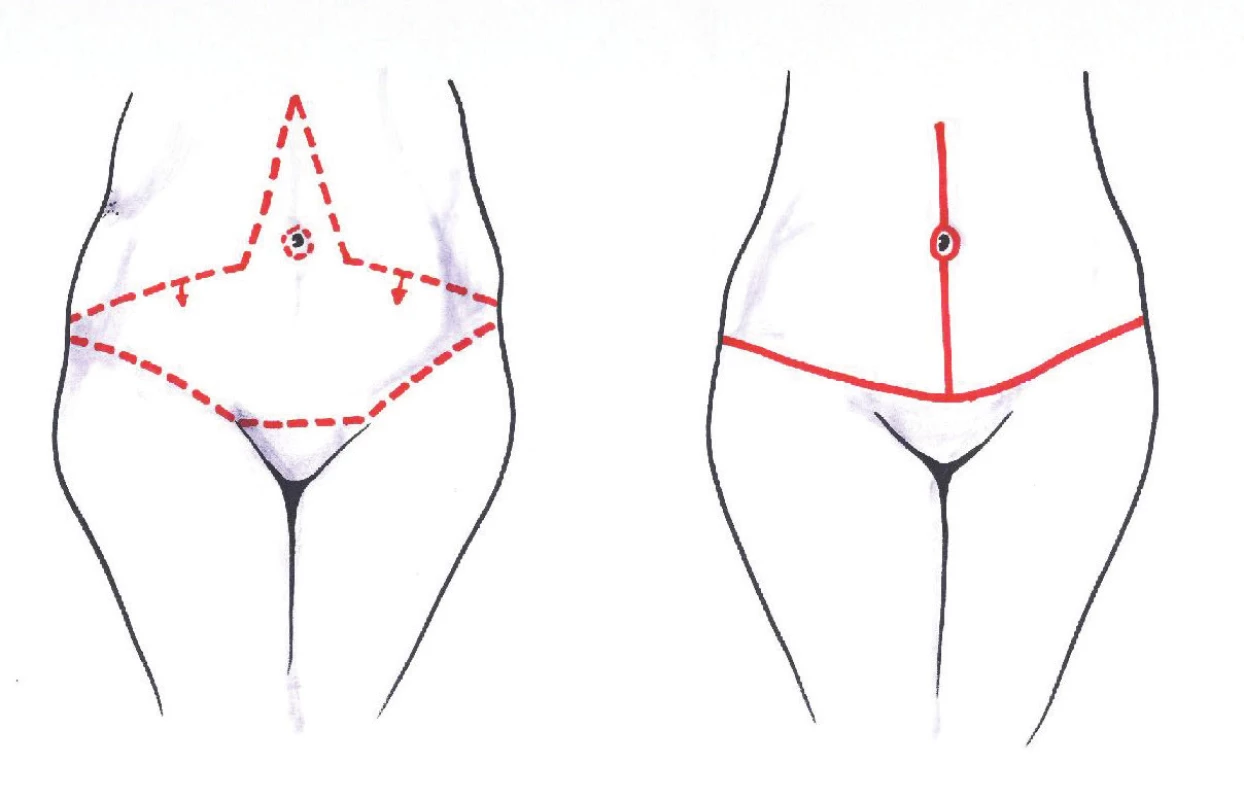 Fleur-de-lis
Fig. 10: Fleur-de-lis