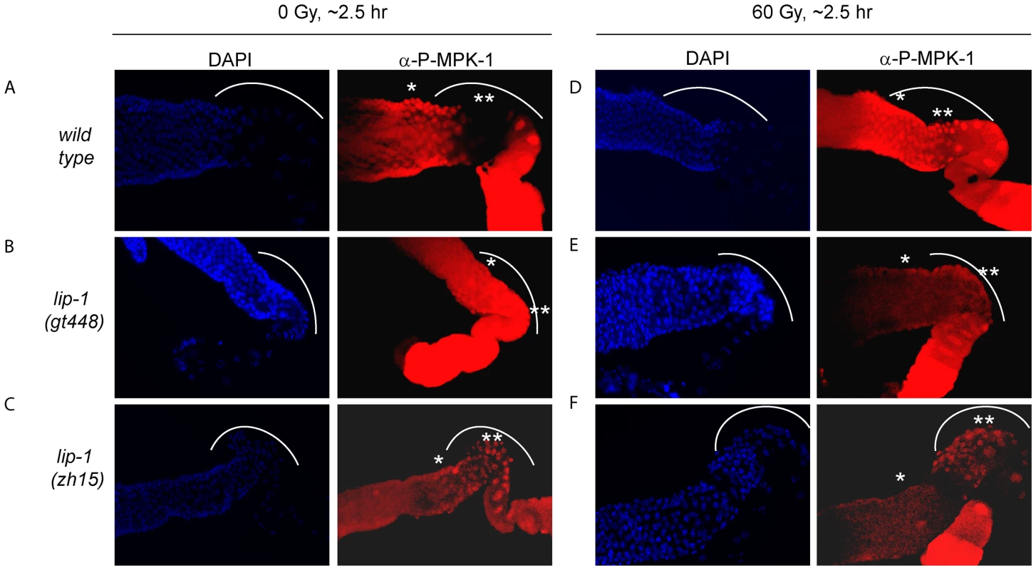 MPK-1 phosphorylation is induced in late pachytene and early diplotene in wild-type germlines following irradiation.