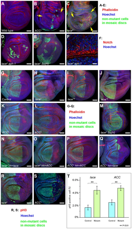 Analysis of tissue overgrowth and cell proliferation in <i>lace</i> and <i>ACC</i> mutant cells.