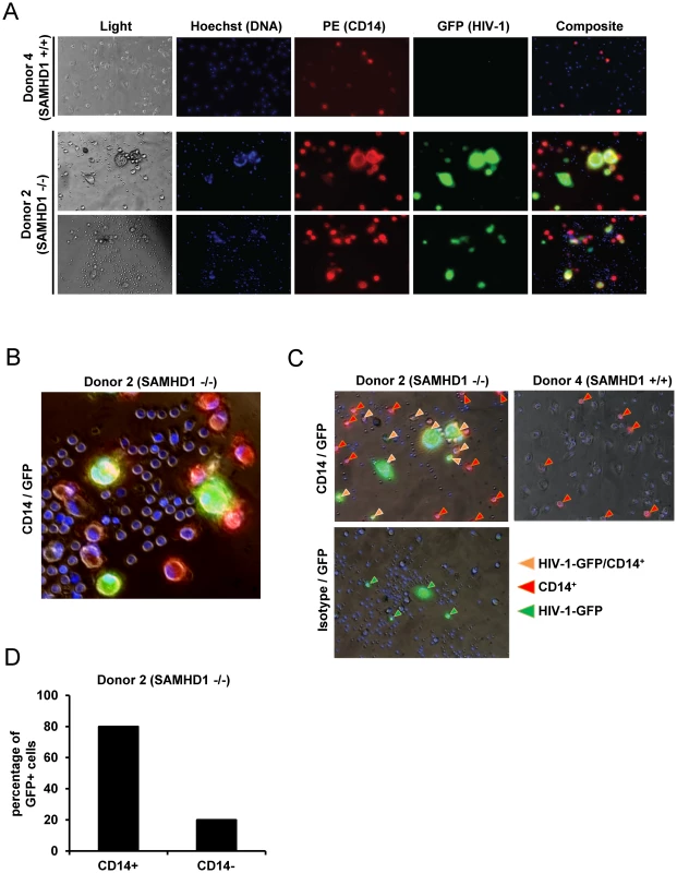 Monocytic cells lacking SAMHD1 are target cells for HIV-1.