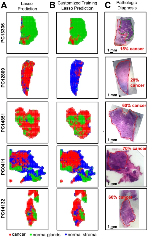 Statistical predictions in comparison with histopathologic diagnosis for samples of mixed histology.