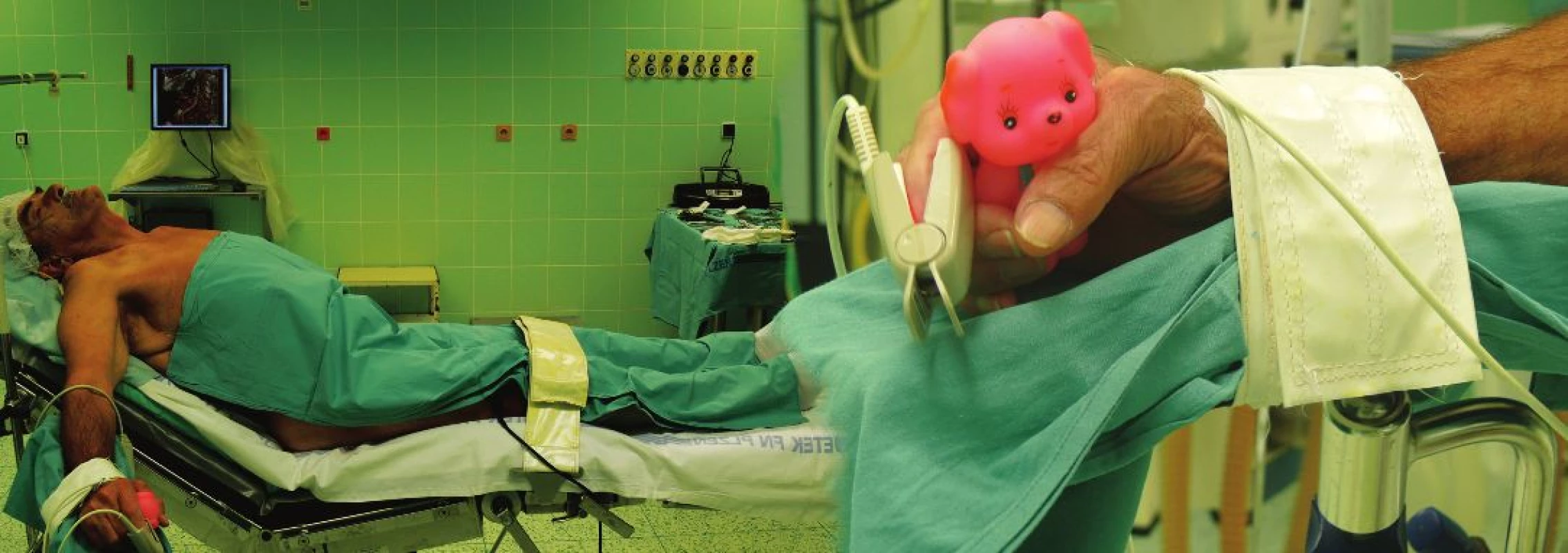 Nemocný připravený k operaci ACI vlevo v lokoregionální anestezii (Detail na nástroj k monitoraci krevního zásobení mozku v pravé ruce.)
Fig. 4: Patient is ready for surgery of the left ICA under locoregional anesthesia (Detail of a tool for monitoring blood supply to the brain in the right hand.)