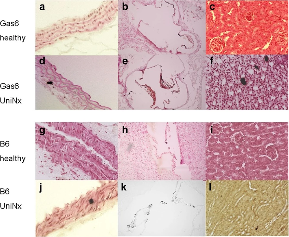 Localisation of calcium deposits; <i>Von Kossa</i> staining of the aorta (a, d, g, j), heart (b, e, h, k) and kidney (c, f, i, l) after uninephrectomy in WT (Wildtype) compared to Gas6<sup>-/-</sup> mice. WT; Magnification 400x